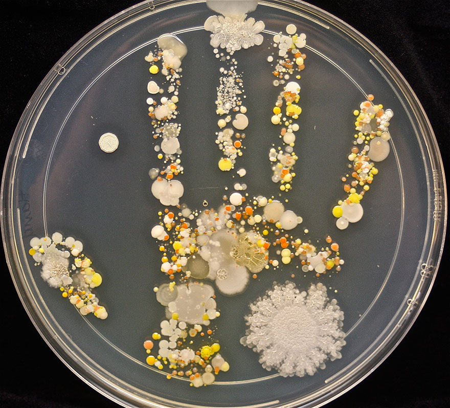 bacteria-petri-dish-microbe-8-year-old-b