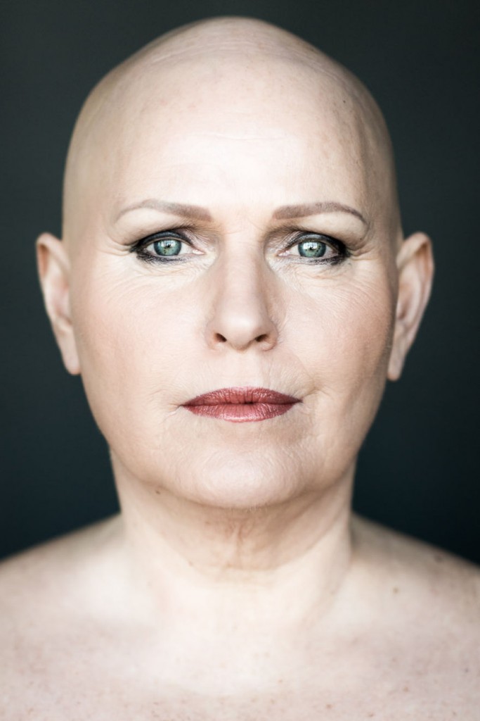 Women With Alopecia Captured In Beautiful Pictures Challenging Gender