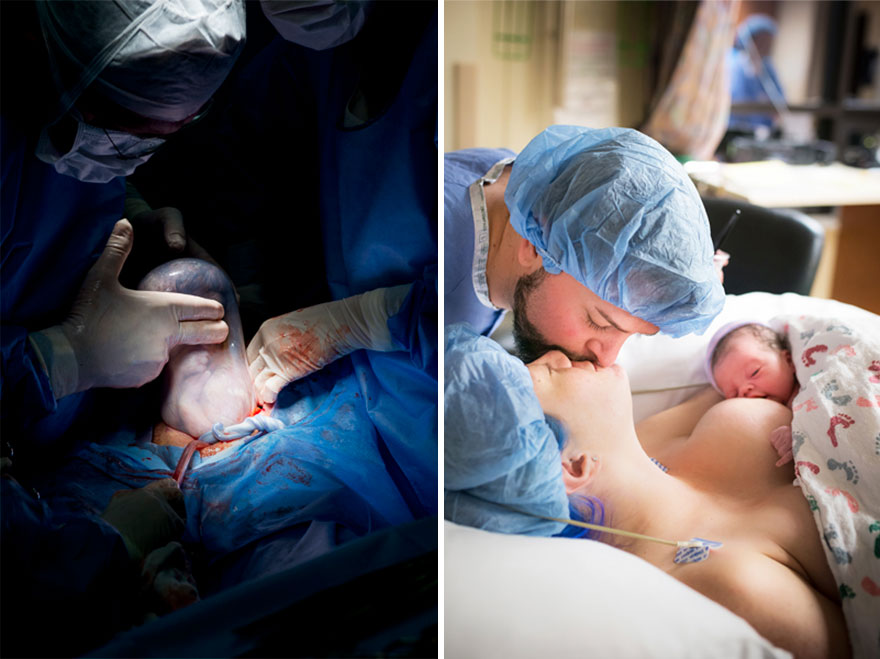 professional-birth-photography-competition-winners-labor-delivery-postpartum-16