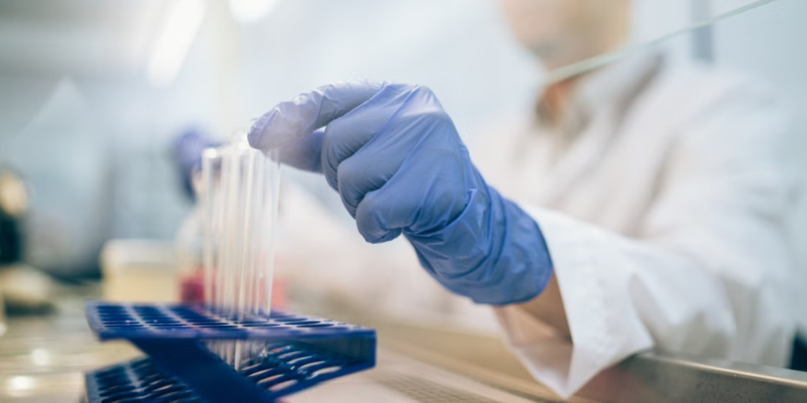 How To Choose The Right Recombinant Human HGF Protein For Laboratory Applications