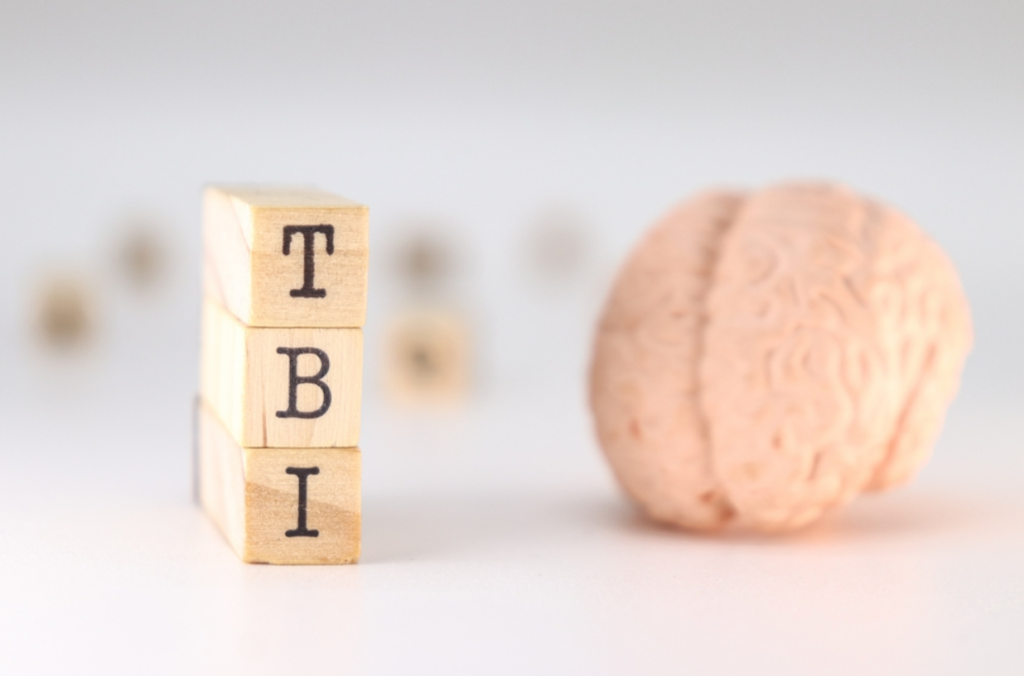 How a Traumatic Brain Injury Lawyer Approaches the Evidence Others May Miss art-sheep.com