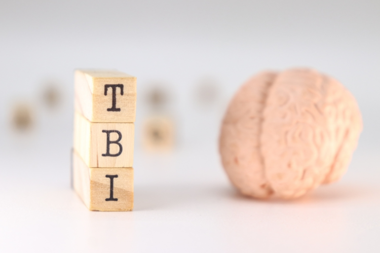 How a Traumatic Brain Injury Lawyer Approaches the Evidence Others May Miss art-sheep.com