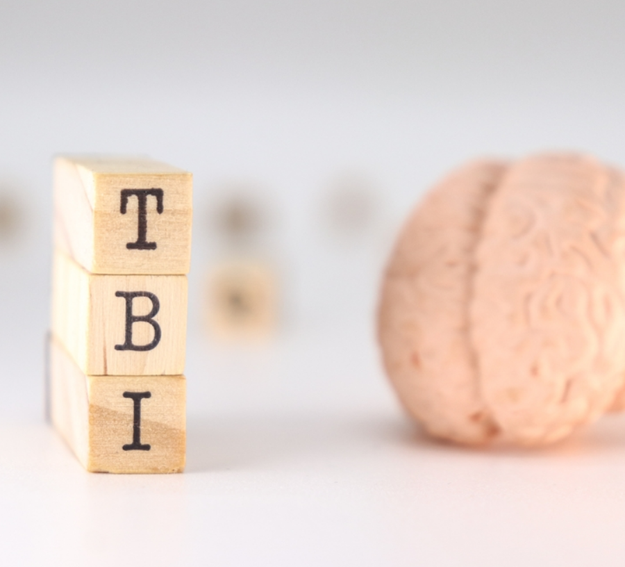 How a Traumatic Brain Injury Lawyer Approaches the Evidence Others May Miss art-sheep.com