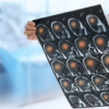What Are the Causes of Brain Hemorrhage During Birth - art-sheep.com