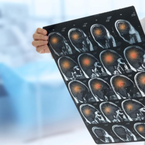 What Are the Causes of Brain Hemorrhage During Birth - art-sheep.com
